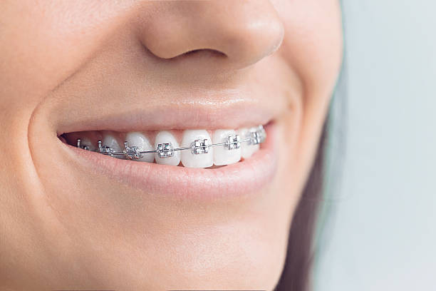 Dental Inlays and Onlays in Ripon, CA